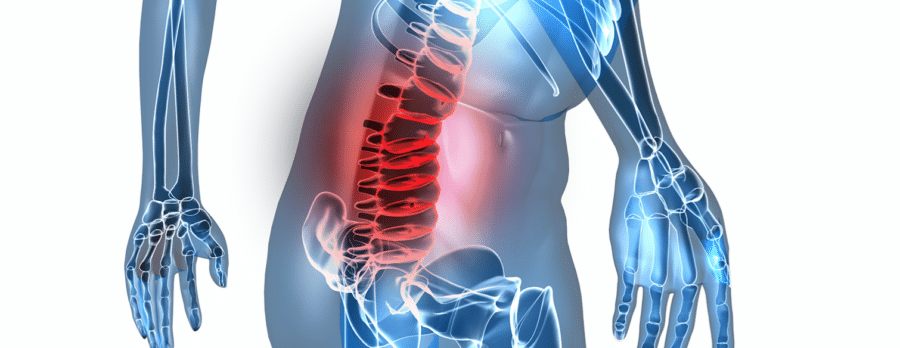 Can Back Pain Cause Stomach Pain Texas Spine Clinic